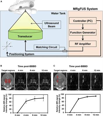 Diminished Expression of P-glycoprotein Using Focused Ultrasound Is Associated With JNK-Dependent Signaling Pathway in Cerebral Blood Vessels